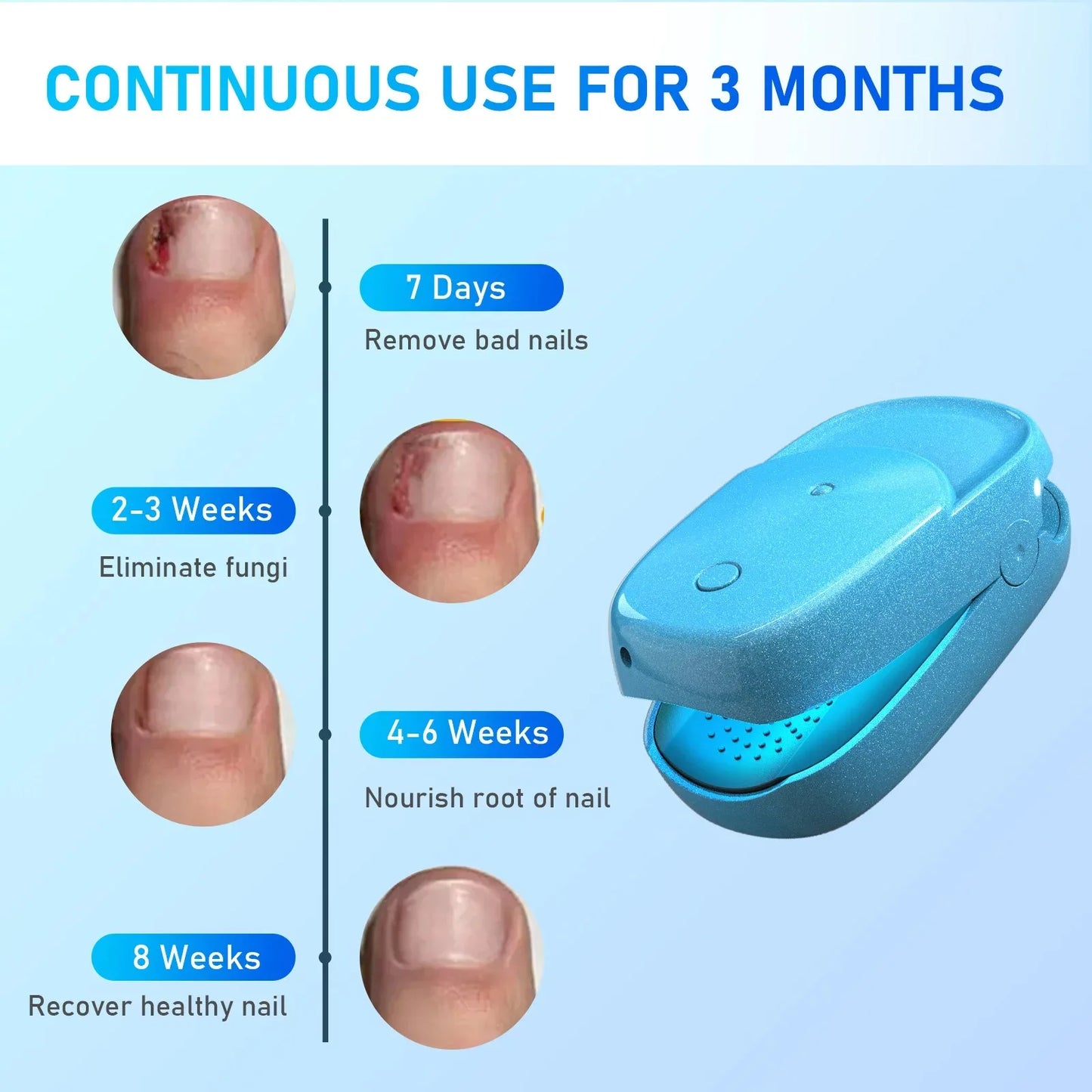 Nail Fungal Device Repair Fingernail Fast Repair Nails Fungus Toenail Care Foot Onychomycosis Fungus Fingernail Nail Removes