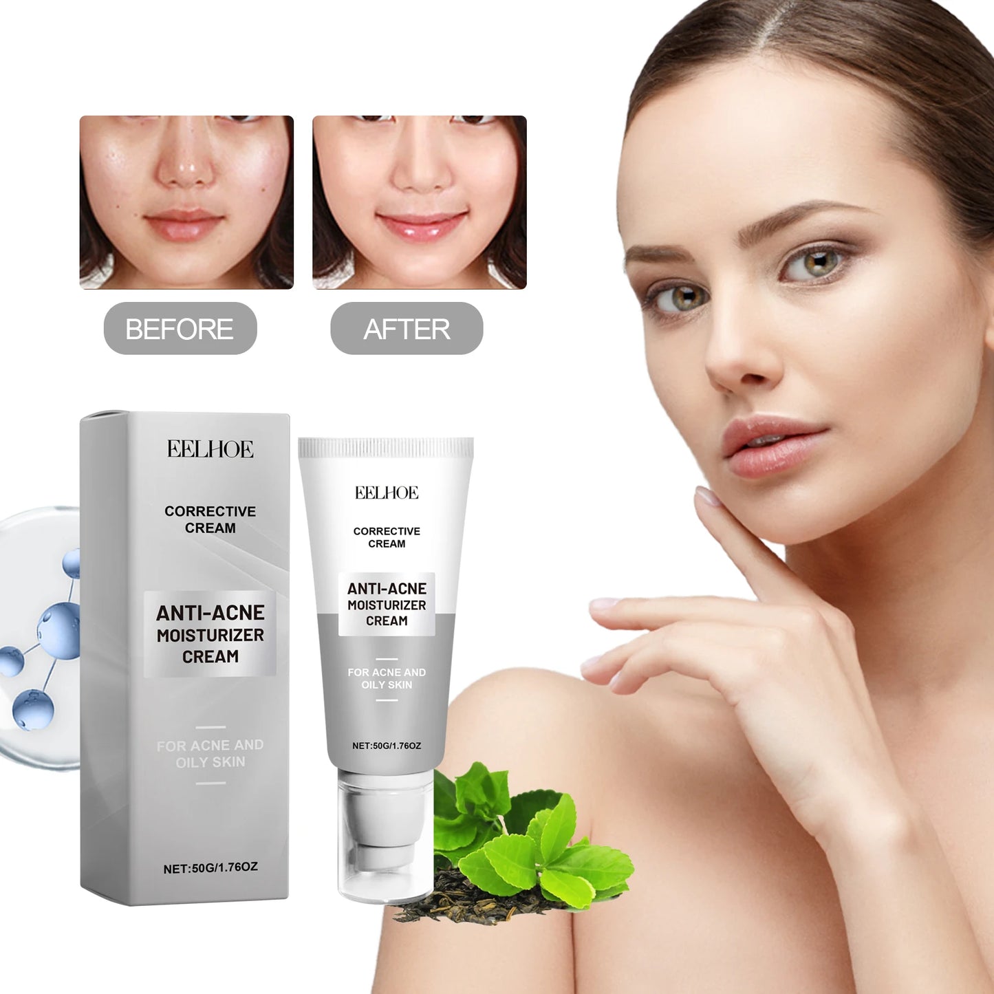 Whitening Cream Anti Freckle Face Cream, Remove The Black，Melasma Dark Spot Acne Deposits On The Skin,Brighten Skin Care